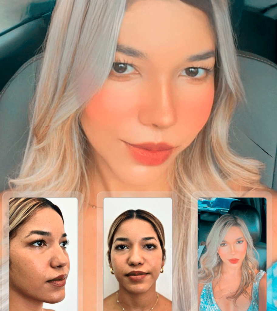 rhinoplasty dominican republic