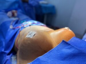 breast reduction surgery in santo domingo dominican republic dr manuel peralta