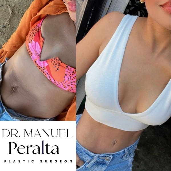 dr manuel peralta plastic surgeon
